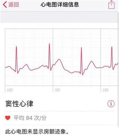 Apple Watch怎么查看心电图